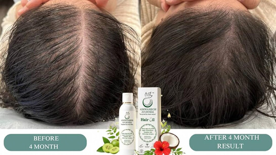 Buy Ashwamegh Ayurvedic Hair Oil for Hair Fall Control & Hair Growth | Bhringraj, Ashwagandha & amlaa 9 Herbs | Natural Hair Oil for Men & Women | Anti Hairfall | 100ml Online 